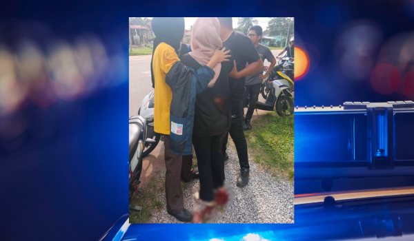 mangsa berusia 18 tahun yang bekerja sebagai operator di sebuah kilang telah dibawa ke Hospital Melaka untuk mendapatkan rawatan/Foto media sosial