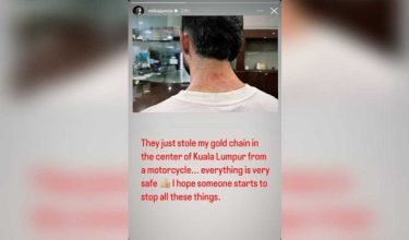 Tangkap layar paparan Instagram Story Mika Junco yang menunjukkan kecederaan ringan yang dialaminya dan turut kehilangan rantai emas