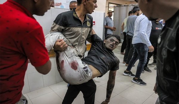 EDITORS NOTE: Graphic content / A man who was injured following a reported Israeli strike on a tent according to medics, is carried by another to the trauma ward for treatment at Nasser Medical Complex in Khan Yunis in the southern Gaza Strip on July 8, 2026. Violence continues in Gaza despite a ceasefire between Hamas and Israel in place since October 2025. At least 1,072 Palestinians have been killed in the territory since the truce took effect, according to the territory's health ministry, which operates under Hamas authority and whose figures are considered reliable by the United Nations. (Photo by Bashar Taleb / AFP)