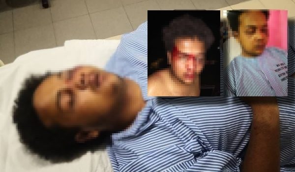 Mangsa mengalami kecederaan lebam di bahagian mata kiri dan sakit seluruh badan