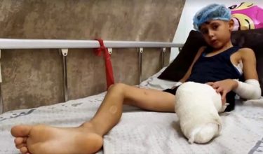 Mohammad Hassan, antara ribuan kanak-kanak yang terpaksa diamputasi akibat serangan Israel / Foto REUTERS