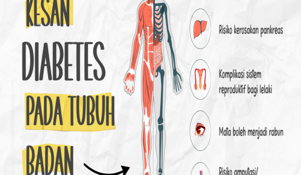 2712-DIABETES