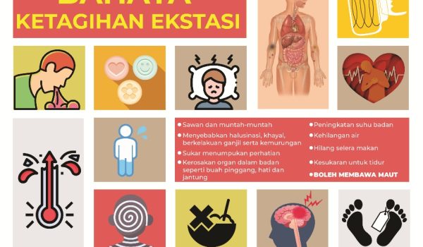 3101-EKSTASI